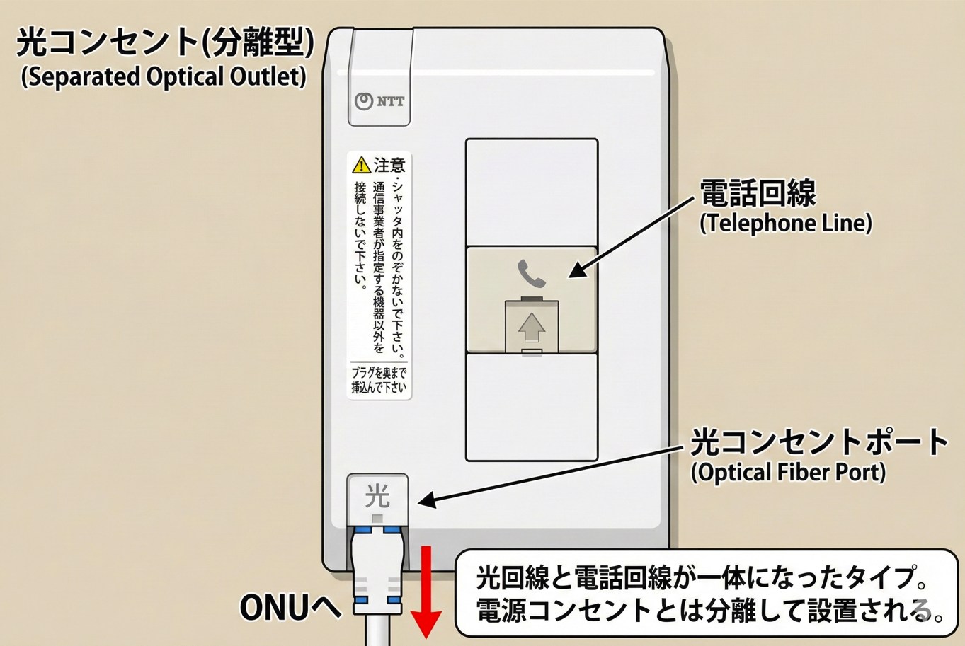 光コンセント分離型のイメージ